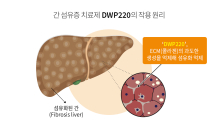 대웅제약, 중증 간 섬유증 ‘경구용 신약’ 세계 최초 개발 나선다