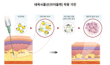 대웅제약 지방파괴주사 '브이올렛', 팔뚝살도 빼준다