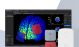 뉴로핏, 뇌졸중 후유증 개선 위한 ‘개인 맞춤형 tDCS 솔루션’ 혁신의료기술 선정