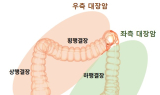 여성 대장암 절반 이상이 ‘오른쪽’…암 발생 경로부터 달랐다