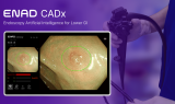 아이넥스, 국내 최초 내시경 AI 수가 절차 진입…ENAD CADx 혁신의료기기 통합심사 통과 