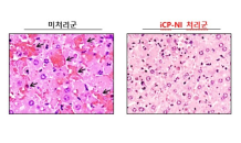 셀리버리, 중증패혈증 치료신약 iCP-NI 임상시험시료 대량생산 계약체결