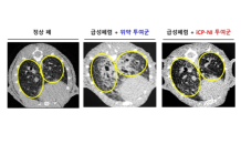 셀리버리 “사이토카인 폭풍 억제신약, 폐 섬유화 치료효능 확보”