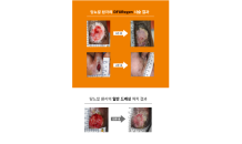 로킷헬스케어, 국제 학술지에 당뇨발 재생플랫폼 연구 초록 게재