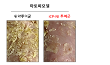 셀리버리 자가면역질환 치료제 'iCP-NI' 아토피 치료효능 입증