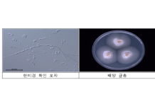 멸종위기식물 털복주머니란, 복원에 한걸음 더 ... 대량 인공증식 성공 미기록 공생균도 발견