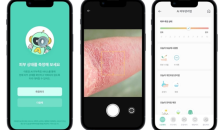 아토맘코리아, ‘아토피 숲 캠프’에 AI 기반 피부측정 솔루션 제공