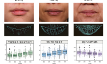 입술노화에 담긴 비밀…LG생활건강, 이미지 빅데이터 분석해 밝혔다