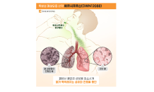 대웅제약, ‘폐섬유증 신약’ IDMC로 안전성 입증…